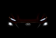 Hyundai Kona : la calandre et les phares #1