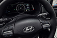 Gims 2018 - Hyundai Kona Electric : 470 km d'autonomie ! #9