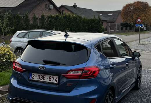 Ford 1.5 EcoBoost S&S mit Leder-Exclusiv-Paket ST