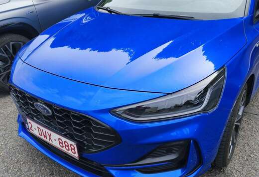Ford 1.0 EcoBoost 125 S&S ST Line X